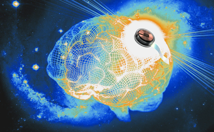 Neurolink Neurolink